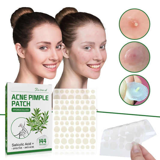 Acne Pimple Patches